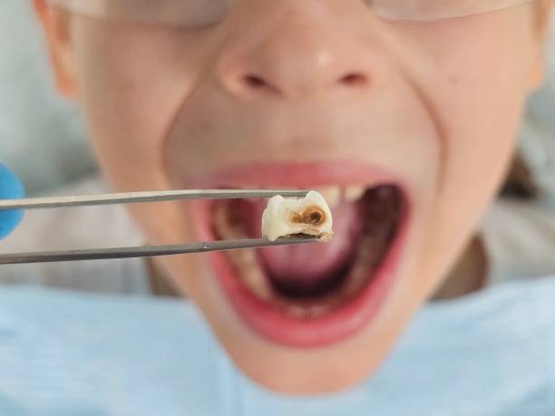 Best Holiday Emergency Dentist in Newkirk, OK
